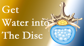 Minster Chiropractic Center uses spinal manipulation and exercise to boost the diffusion of water into the disc which supports the health of the disc.