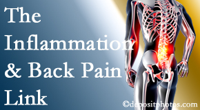 Minster Chiropractic Center tackles the inflammatory process that accompanies back pain as well as the pain itself.