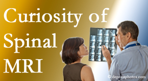 Minster MRIs for spinal stenosis may be revealing…or confusing.