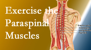 Minster Chiropractic Center explains the importance of paraspinal muscles and their strength for Minster back pain relief.