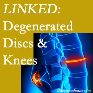 Degenerated discs and degenerated knees are not such unlikely companions. They are seen to be related. Minster patients with a loss of disc height due to disc degeneration often also have knee pain related to degeneration.  