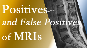 Minster Chiropractic Center carefully chooses when and if MRI images are needed to guide the Minster chiropractic treatment plan. 